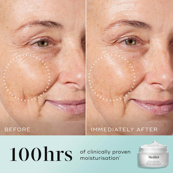 Total Moisture Daily Facial Cream™ hover