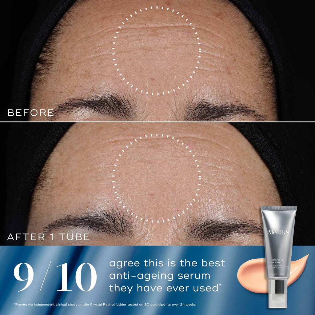 Rejuvenation Reset
