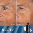 Rejuvenation Reset