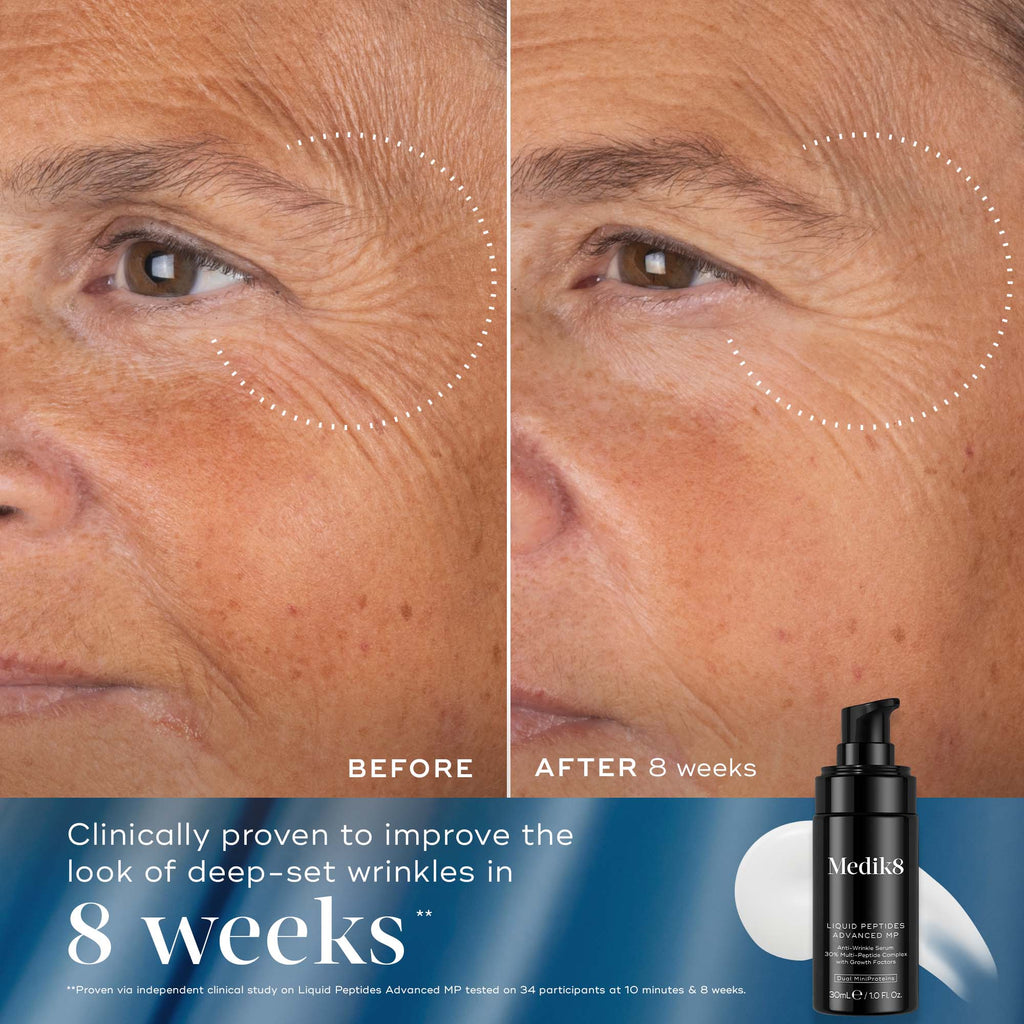 Rejuvenation Reset
