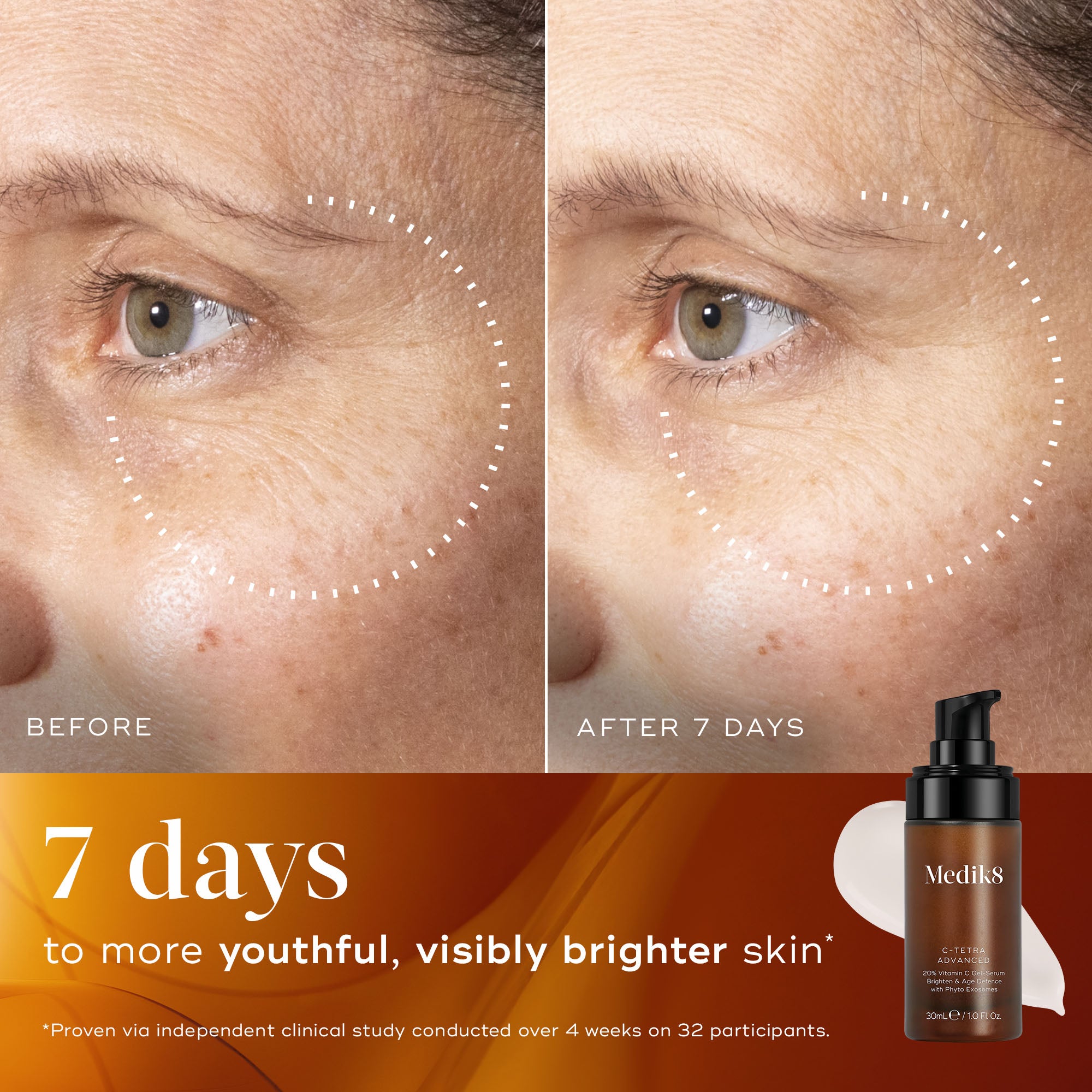 C-Tetra® Advanced – Medik8-INT